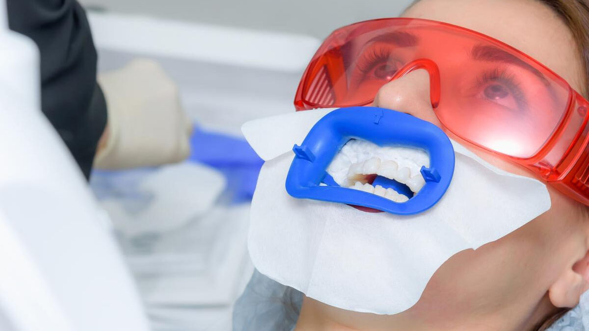 teeth whitening for sensitive